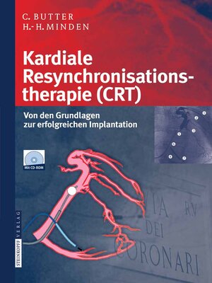 cover image of Kardiale Resynchronisationstherapie (CRT)